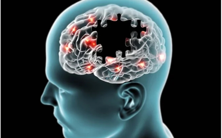 World Alzheimer’s Month: Tackling Alzheimer’s in the UAE with Global and Local Efforts